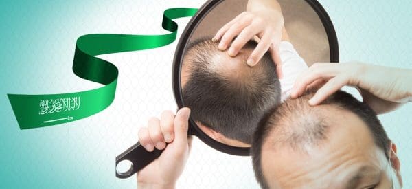 تكلفة زراعة الشعر في السعودية