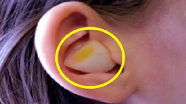 هل آلام الرقبة تؤثر على الأذن