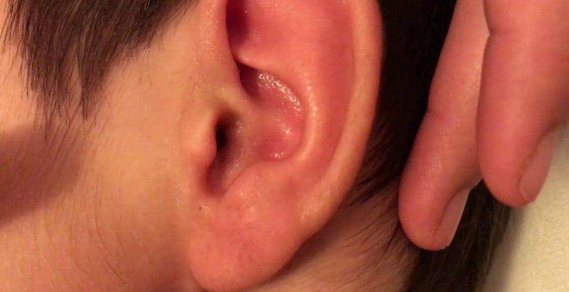 أعراض التهاب الأذن الوسطى عند الكبار 