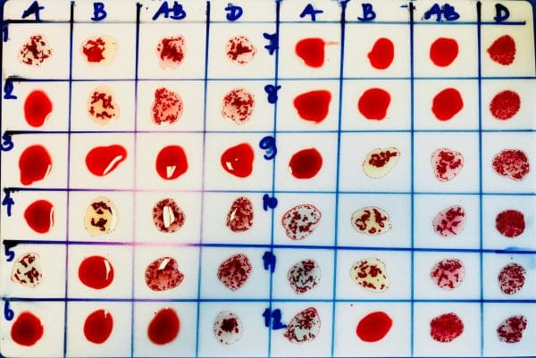 كيف اعرف فصيلة دمي من أبشر