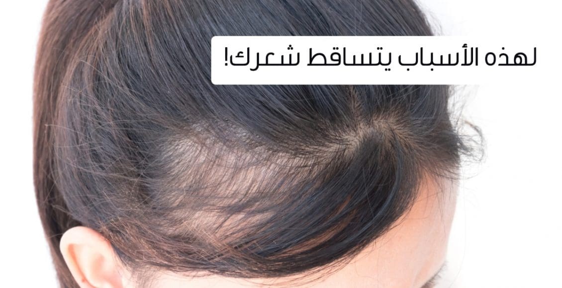علاج تساقط الشعر عند النساء مضمون 100%
