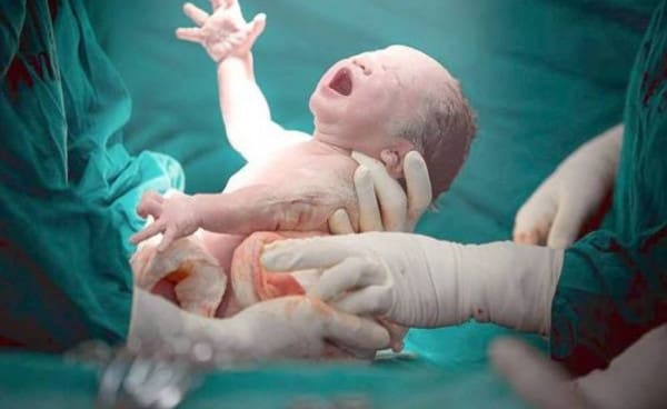 كيفية تتم الولادة الطبيعية في المستشفى بالتفصيل