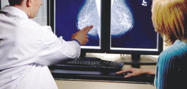 هل كتلة سرطان الثدي مؤلمة