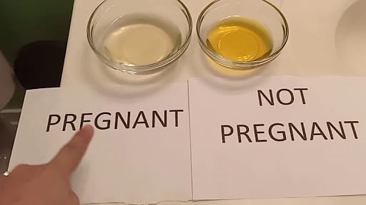 تجربتي مع اختبار الحمل بالملح