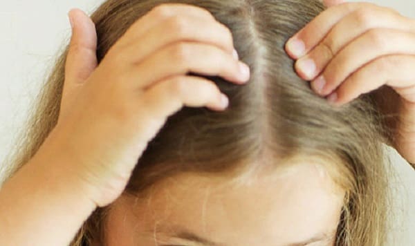 أسباب تساقط الشعر عند الأطفال وطرق علاجه