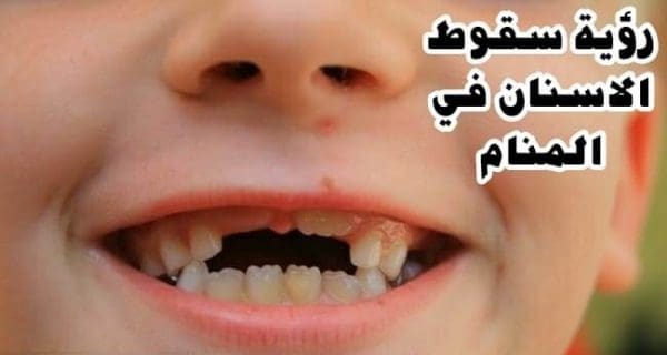 تفسير حلم سقوط الأسنان مع الدم في المنام للفتاة العزباء