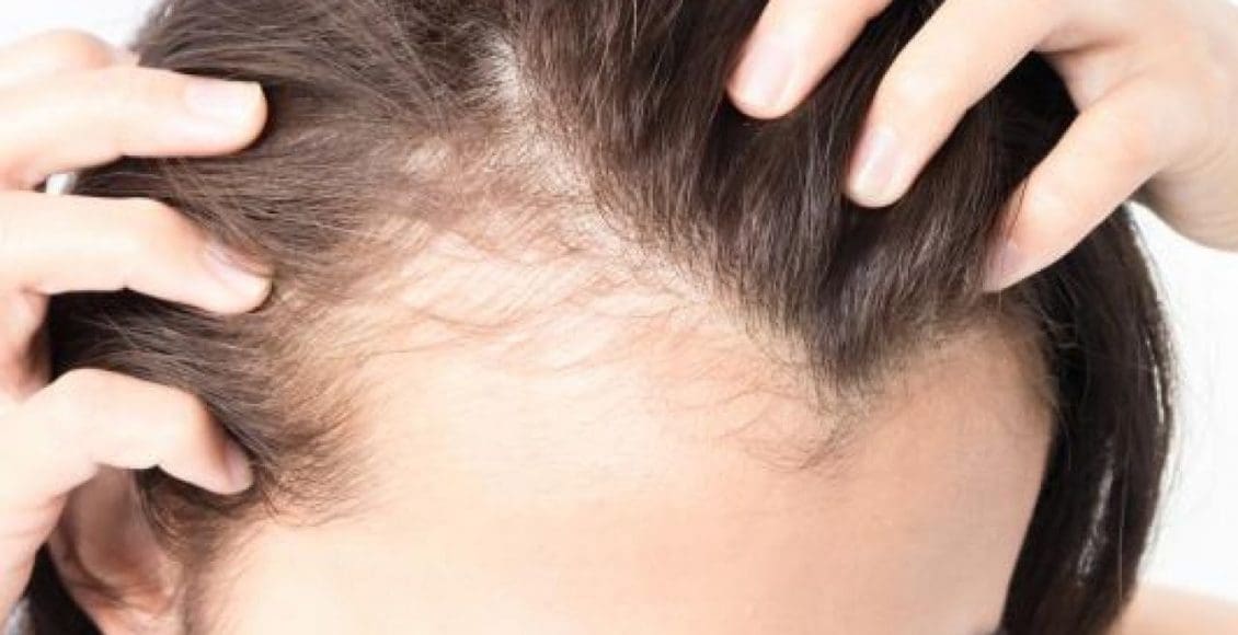 طرق إنبات الشعر في مقدمة الرأس