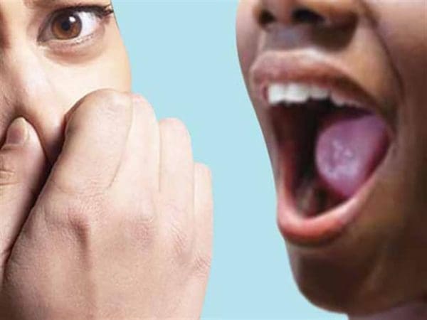 10 طرق بسيطة للتخلص من رائحة الفم الكريهة