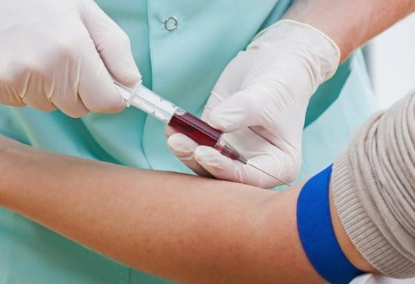 هل تحليل الدم يفطر الصائم؟