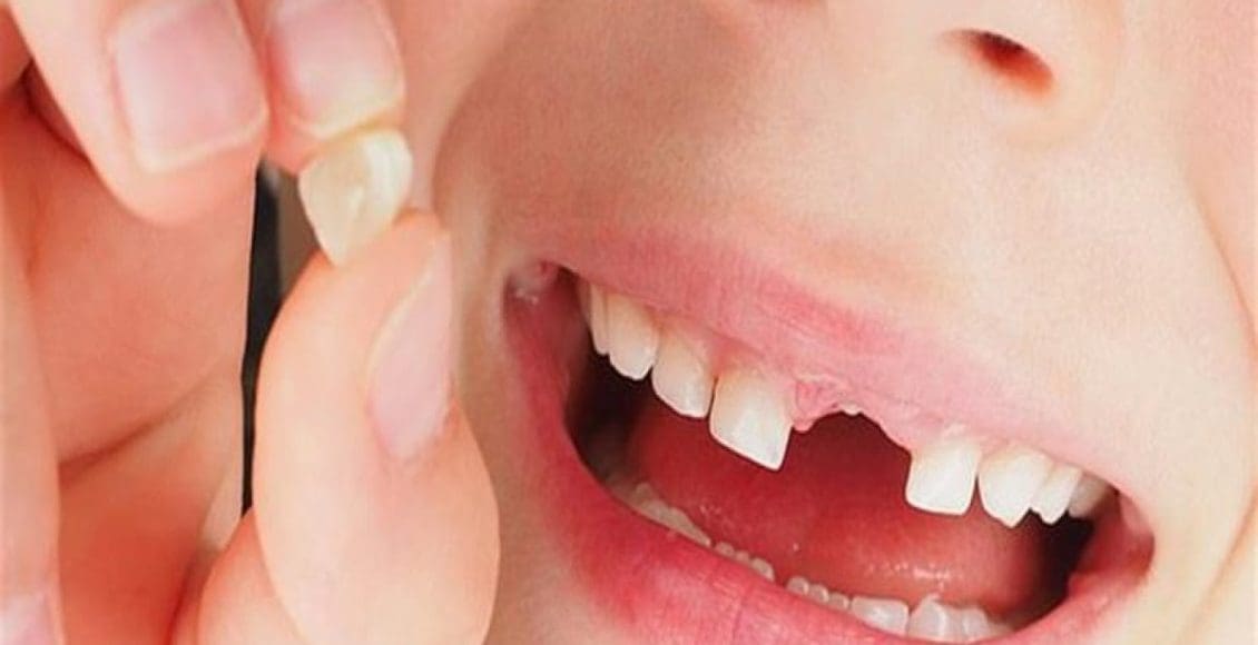 تفسير حلم سقوط الأسنان في المنام