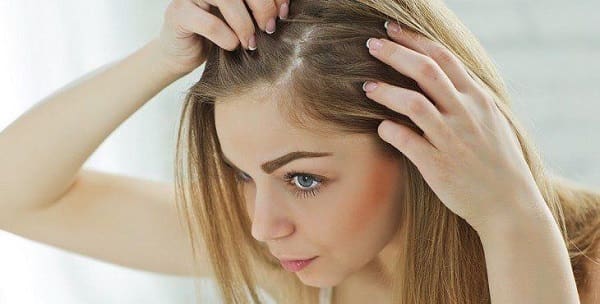 ما هو أفضل علاج لقشرة الشعر؟