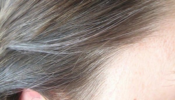 وصفة زيت البصل للقضاء على الشعر الأبيض