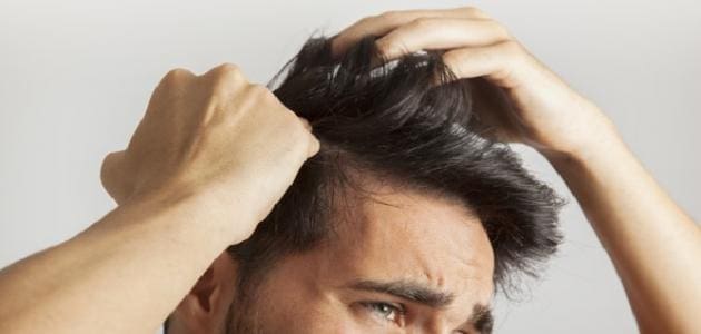 علاج القشرة اللاصقة في الشعر