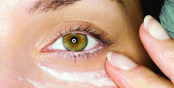علاج تقشر جفن العين