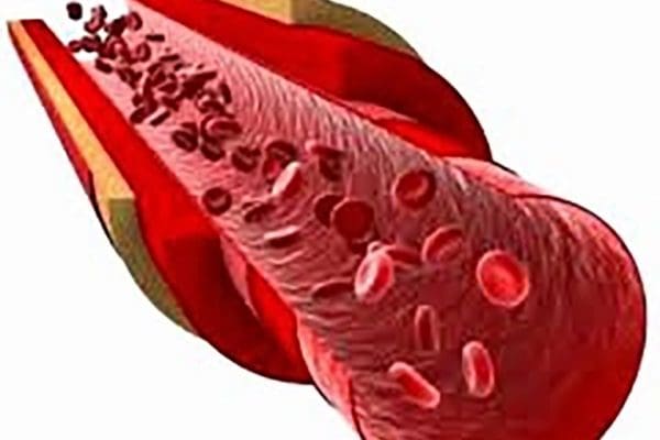 أنواع الكوليسترول في الدم