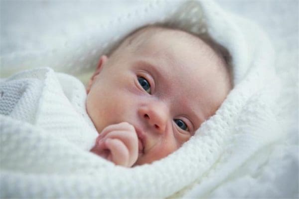شكل أطفال متلازمة داون حديثي الولادة