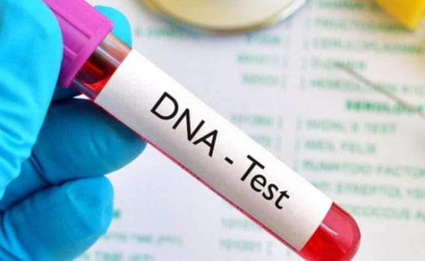 هل تحليل DNA يثبت النسب