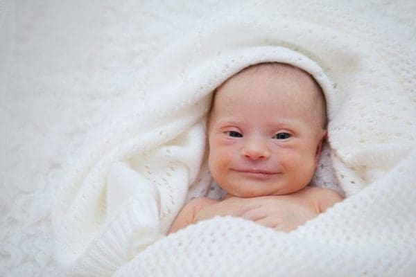 هل يبكي طفل متلازمة داون عند الولادة