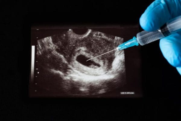 متى يبدأ مفعول إبرة الإجهاض – موقع زيادة