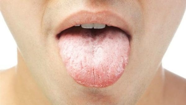 أسباب جفاف الفم والعطش وكثرة التبول