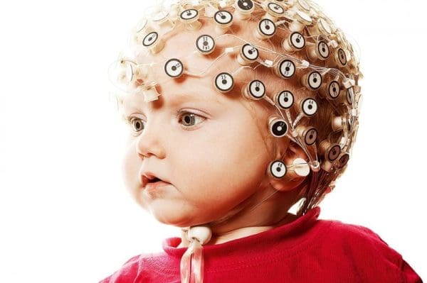 علاج الكهرباء الزائدة في المخ عند الأطفال بالقرآن