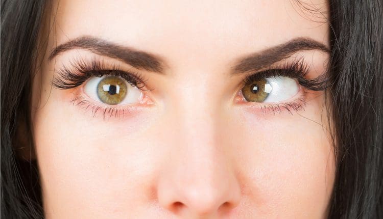 علاج انحراف العين بالتمارين