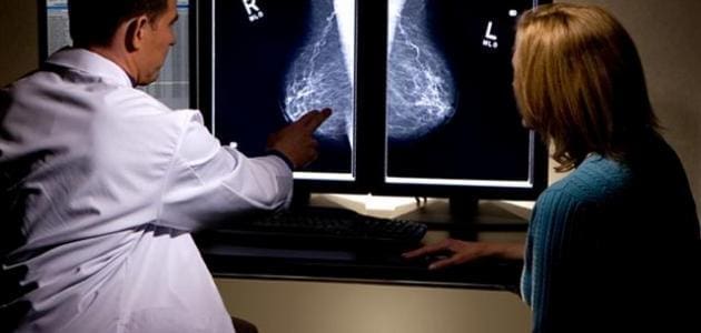 أعراض الورم الحميد في الثدي