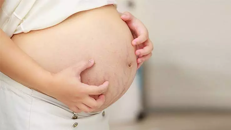 الحكة عند الحامل في الشهر الأول وجنس الجنين