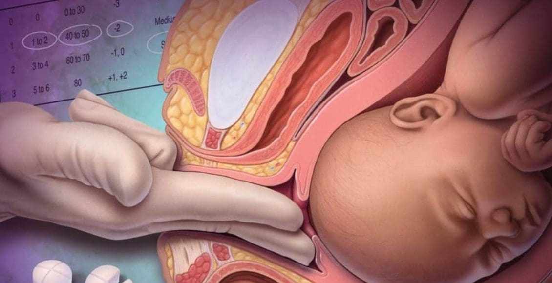 هل الفحص الداخلي للحامل يفتح الرحم ؟