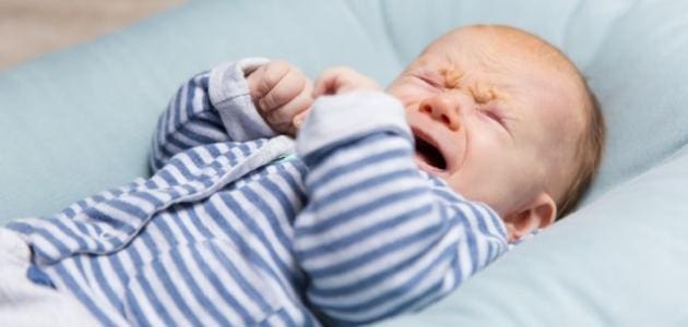 مضاعفات حساسية اللاكتوز عند الرضع