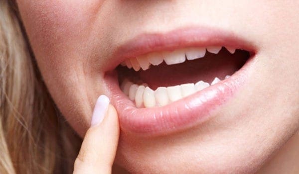 تفسير حلم سقوط الأسنان بدون دم للعزباء