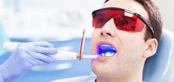 أنواع تقويم الأسنان بالصور واسعارها