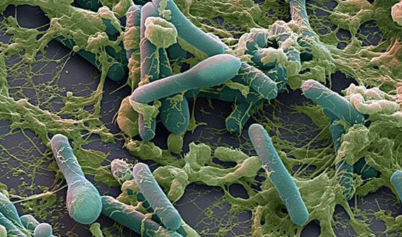أنواع البكتيريا والأمراض التي تسببها