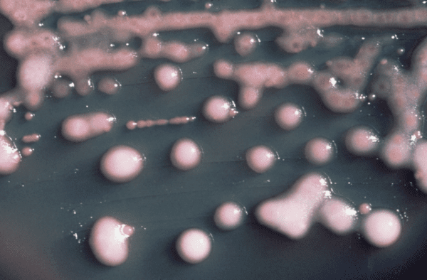 أنواع البكتيريا والأمراض التي تسببها
