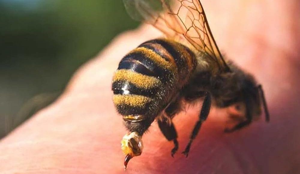 تفسير حلم لدغة النحلة في اليد